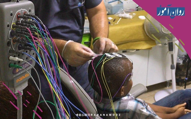 استفاده از دستگاه eeg در درمان نوروتراپی