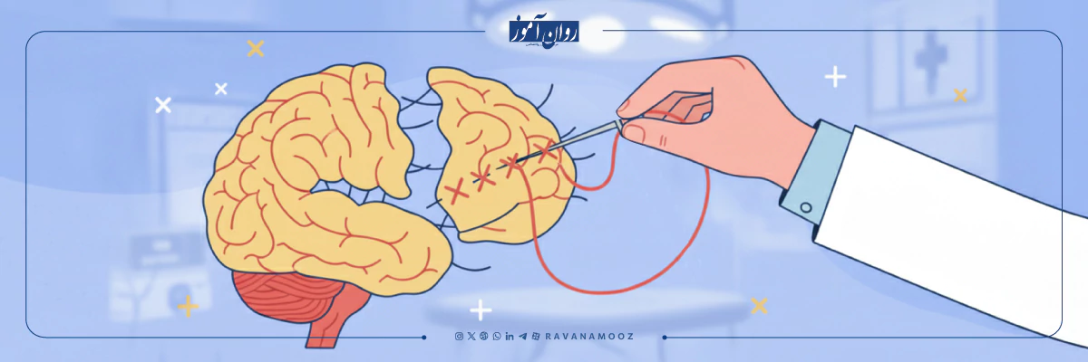 اصلاح خطاهای شناختی