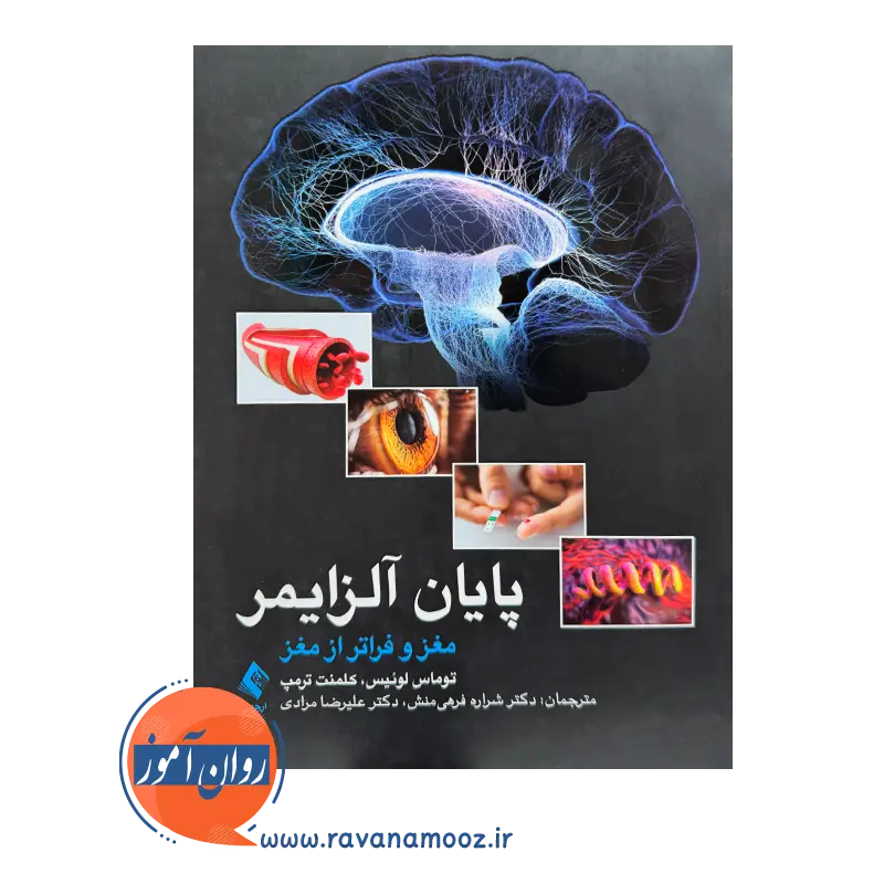 قیمت و خرید کتاب پایان آلزایمر مغز و فراتر از مغز کلمنت ترمپ