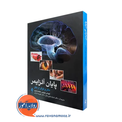 کتاب پایان آلزایمر مغز و فراتر از مغز توماس لوئیس