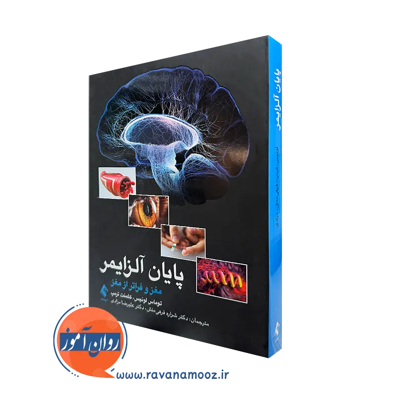 کتاب پایان آلزایمر مغز و فراتر از مغز توماس لوئیس